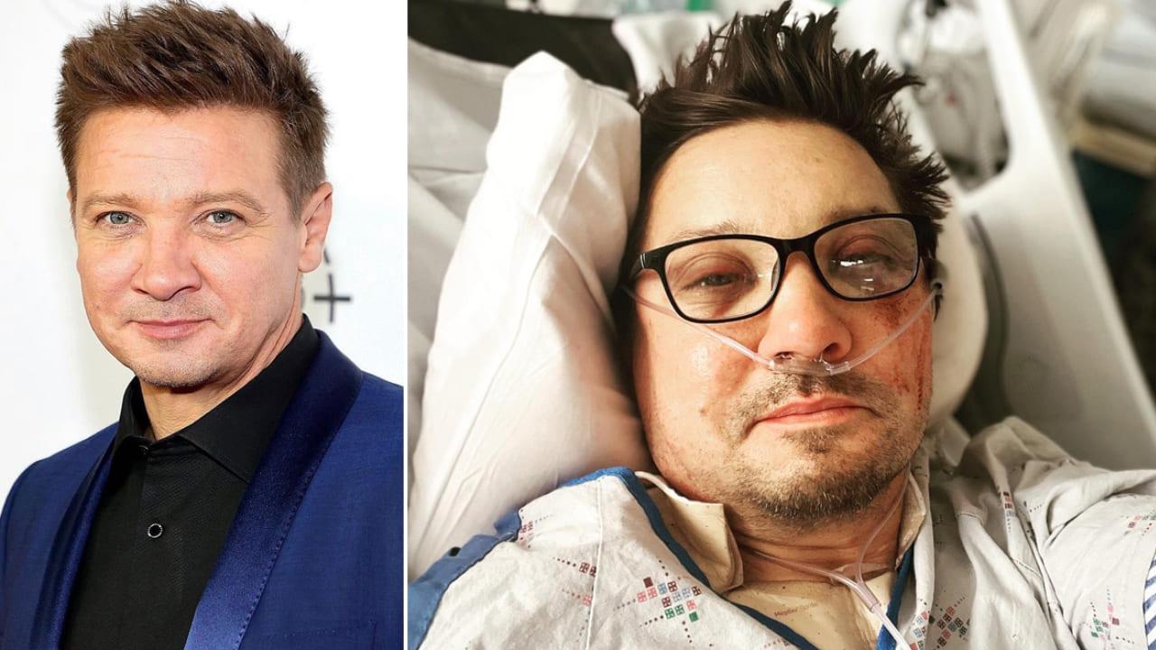 Marvels Hawkeye, Jeremy Renner Posts First Selfie After Snow Plow Accident  On Instagram